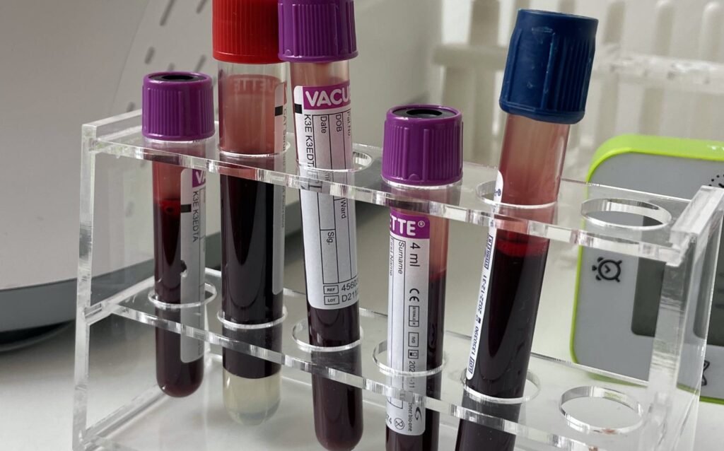 how to read blood test results
