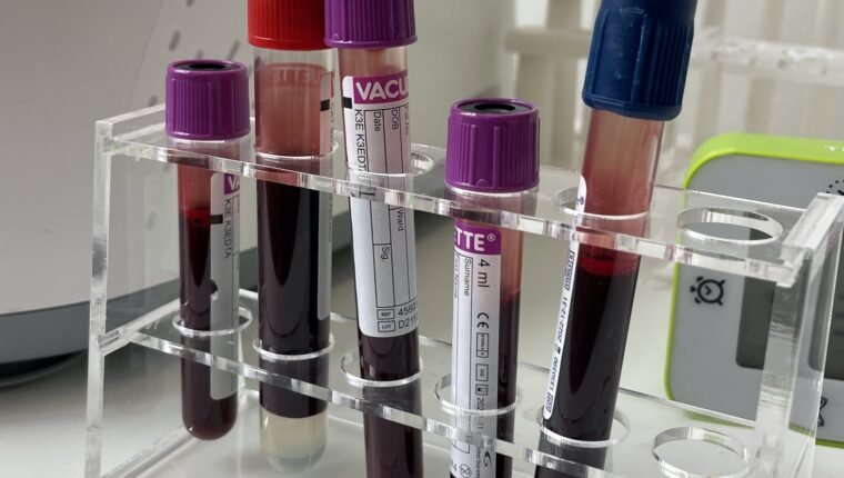 how to read blood test results